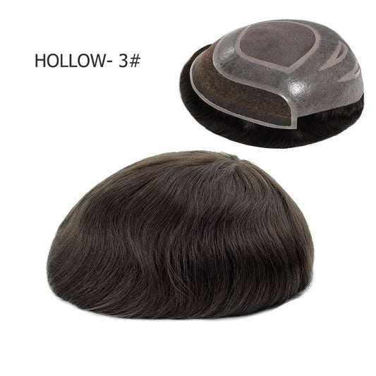 Men's Hair Replacement