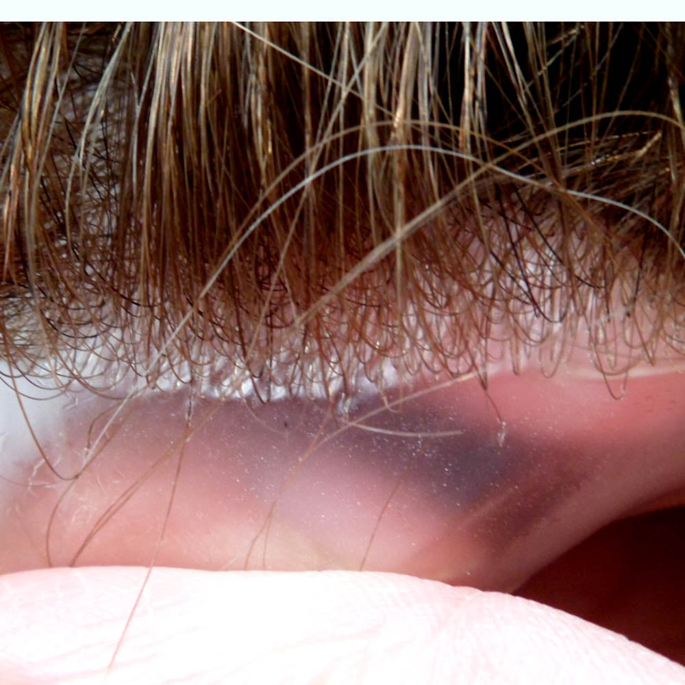 super thin skin toupee