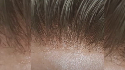 super thin skin toupee hair replacemenet for men
